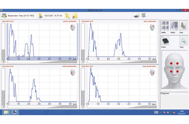 Ултразвуков модул DIGITAL 5 Otopront