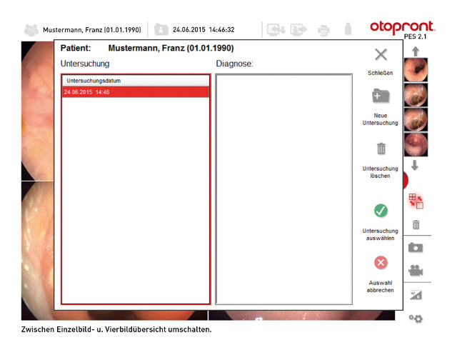 Ендоскопска система PES 2.1 Otopront