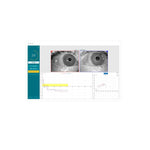 Видеонистагмогравски Очила VisualEyes Interacoustics